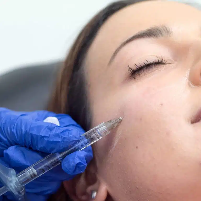 What Is CAHA Filler and How Does It Work?