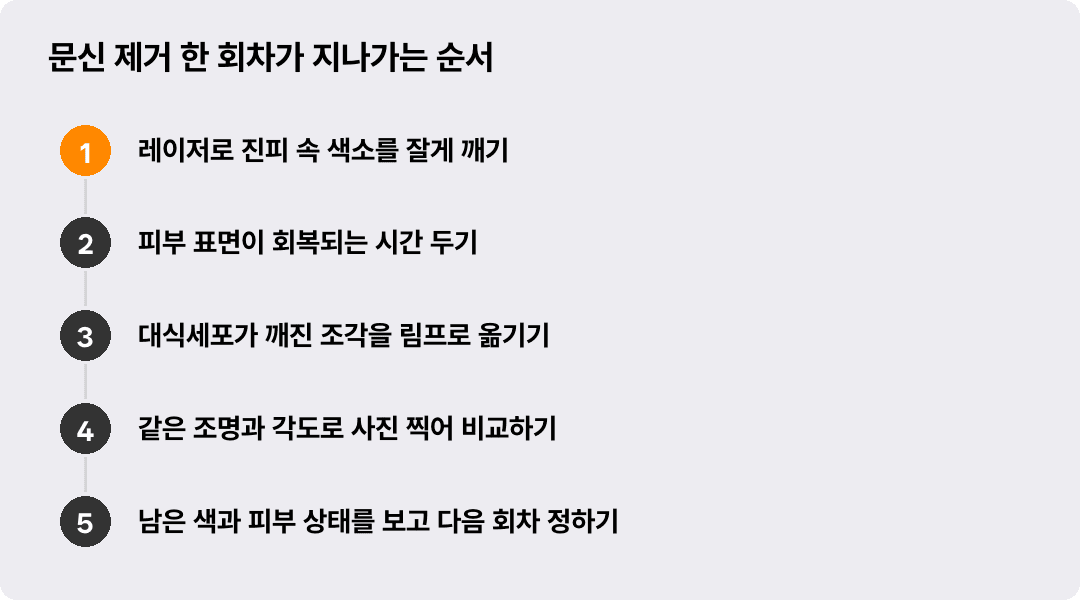 문신 제거 한 회차가 지나가는 순서