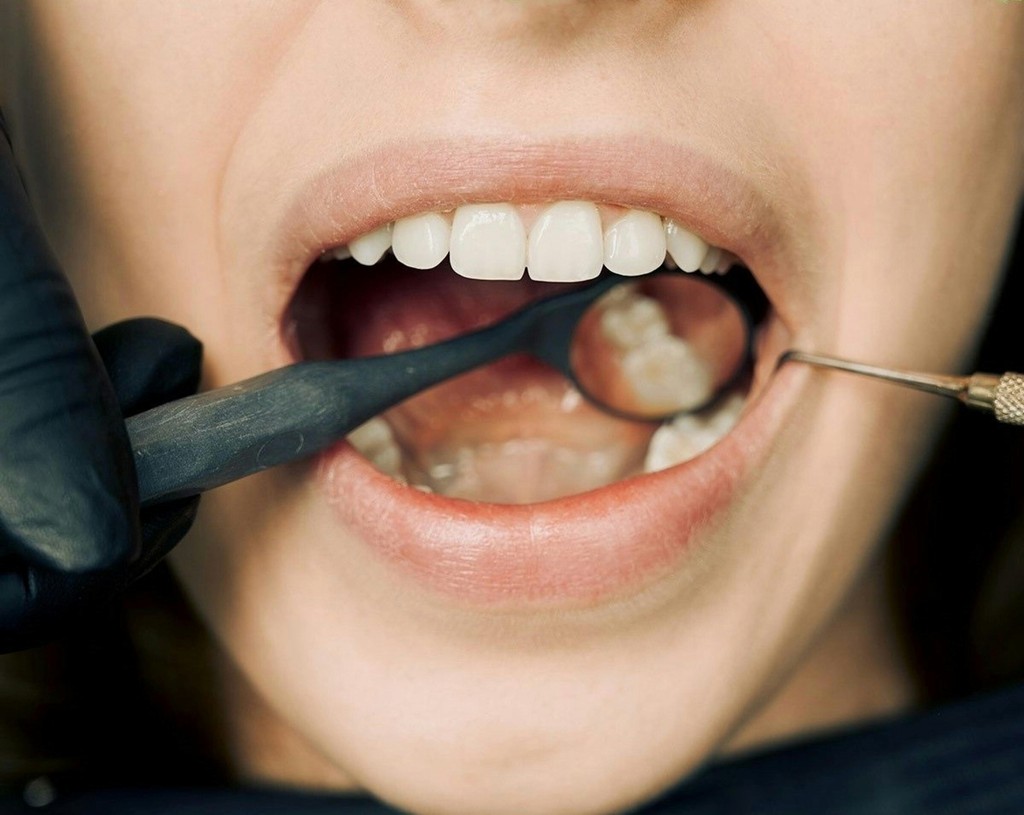 annual dental check-up in hong kong