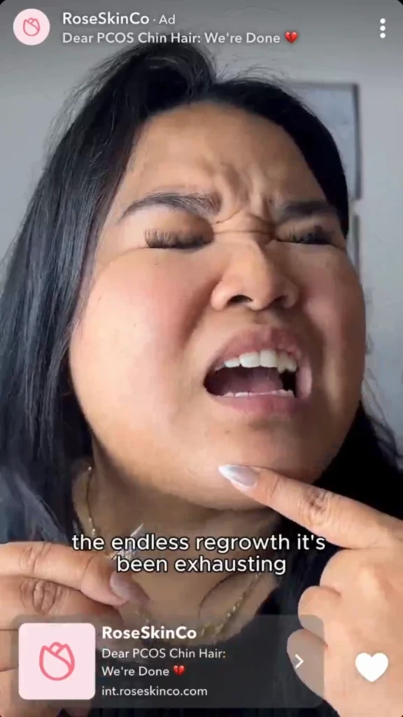 RoseSkinCo Snapchat video ad promoting an at-home beauty product.