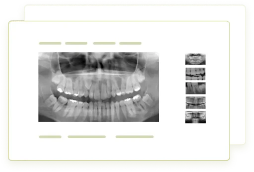 Radiografie dentară gestionată prin dROOT pentru integrarea imaginilor digitale în cabinetele stomatologice.