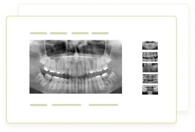 Radiografie dentară gestionată prin dROOT pentru integrarea imaginilor digitale în cabinetele stomatologice.
