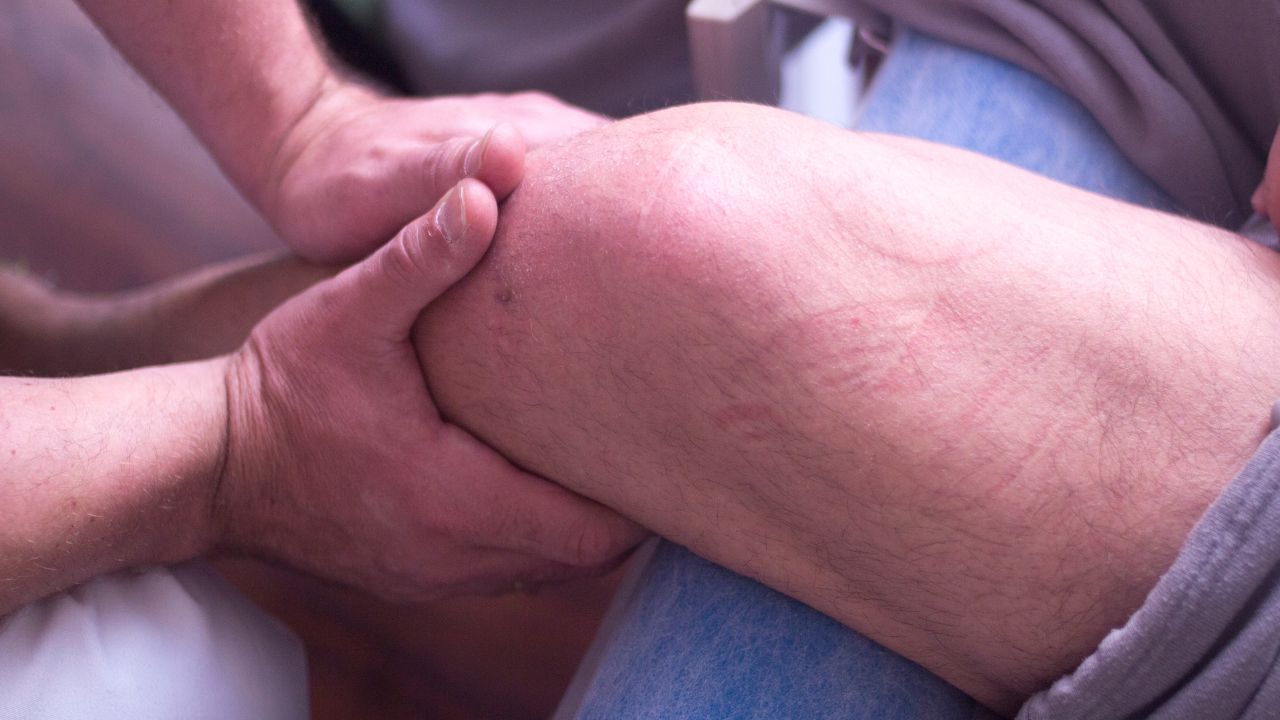 Manual Therapy on knee