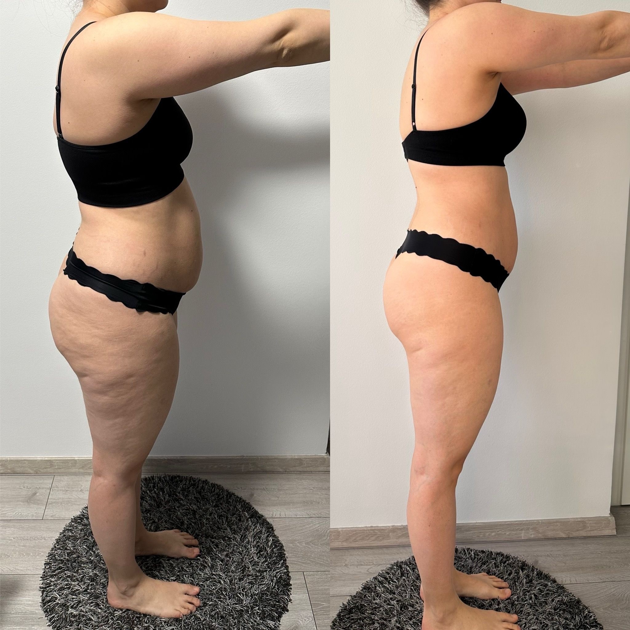 Transformation Photo