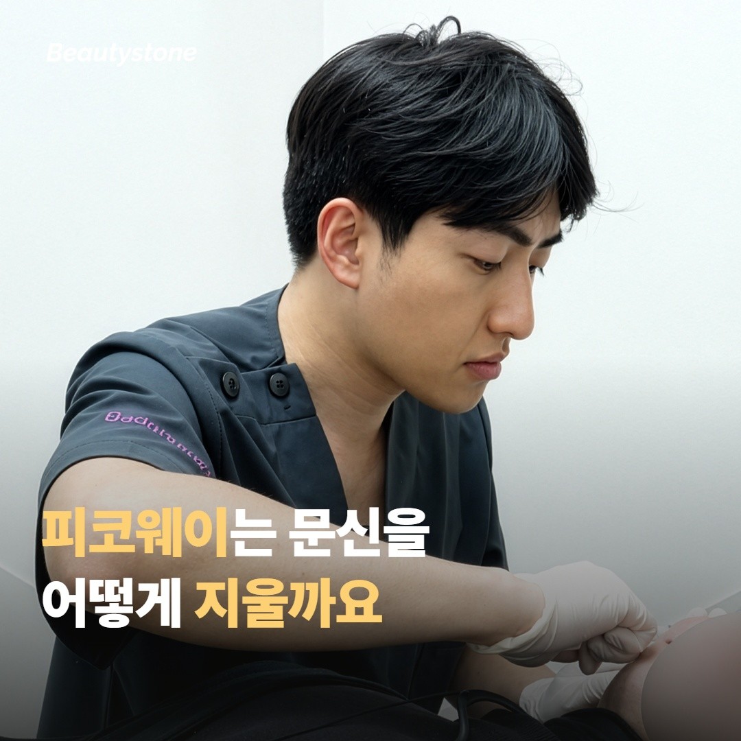 피코웨이는 문신을 어떻게 지우나요
