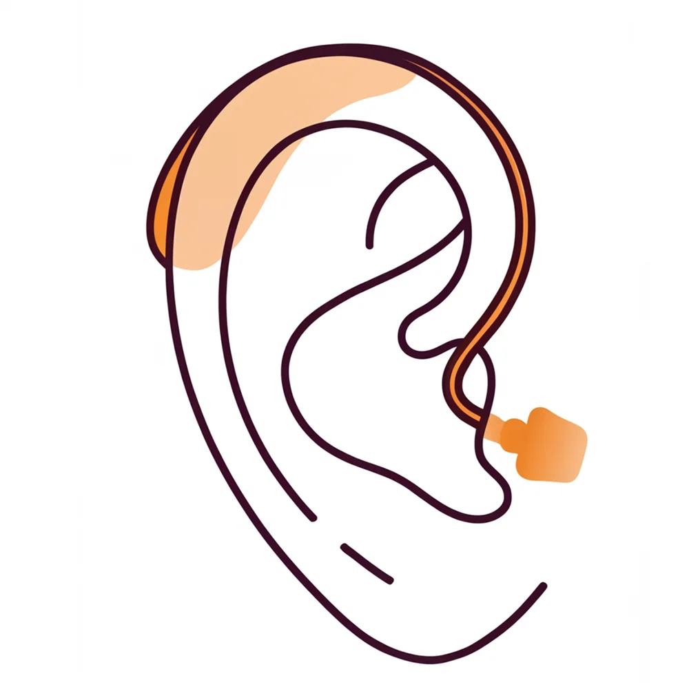 Close-up of a human ear with short hair in the background, focusing on the ear's shape and texture.