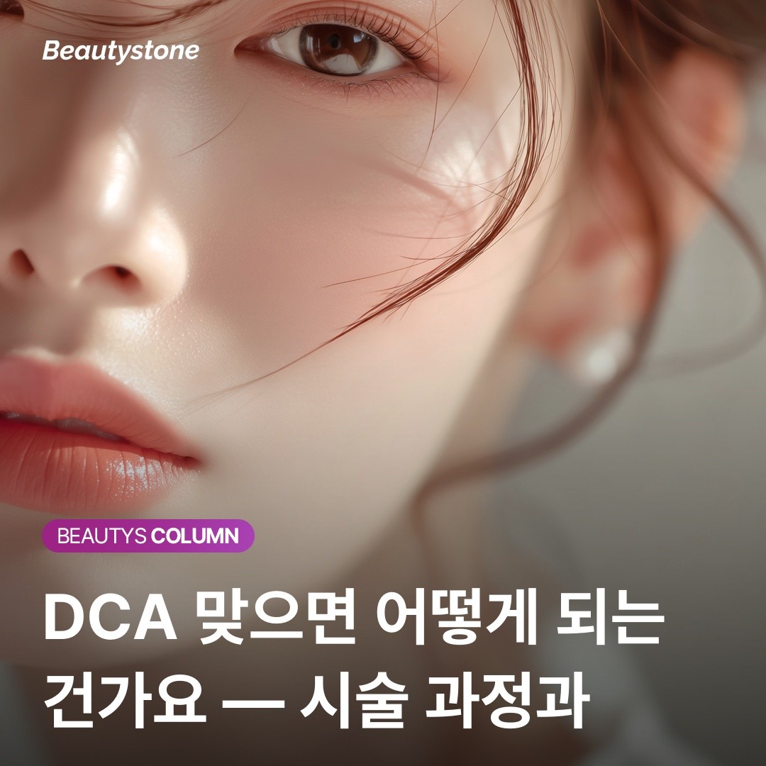 DCA 이중턱 지방분해주사 시술 후 변화 과정