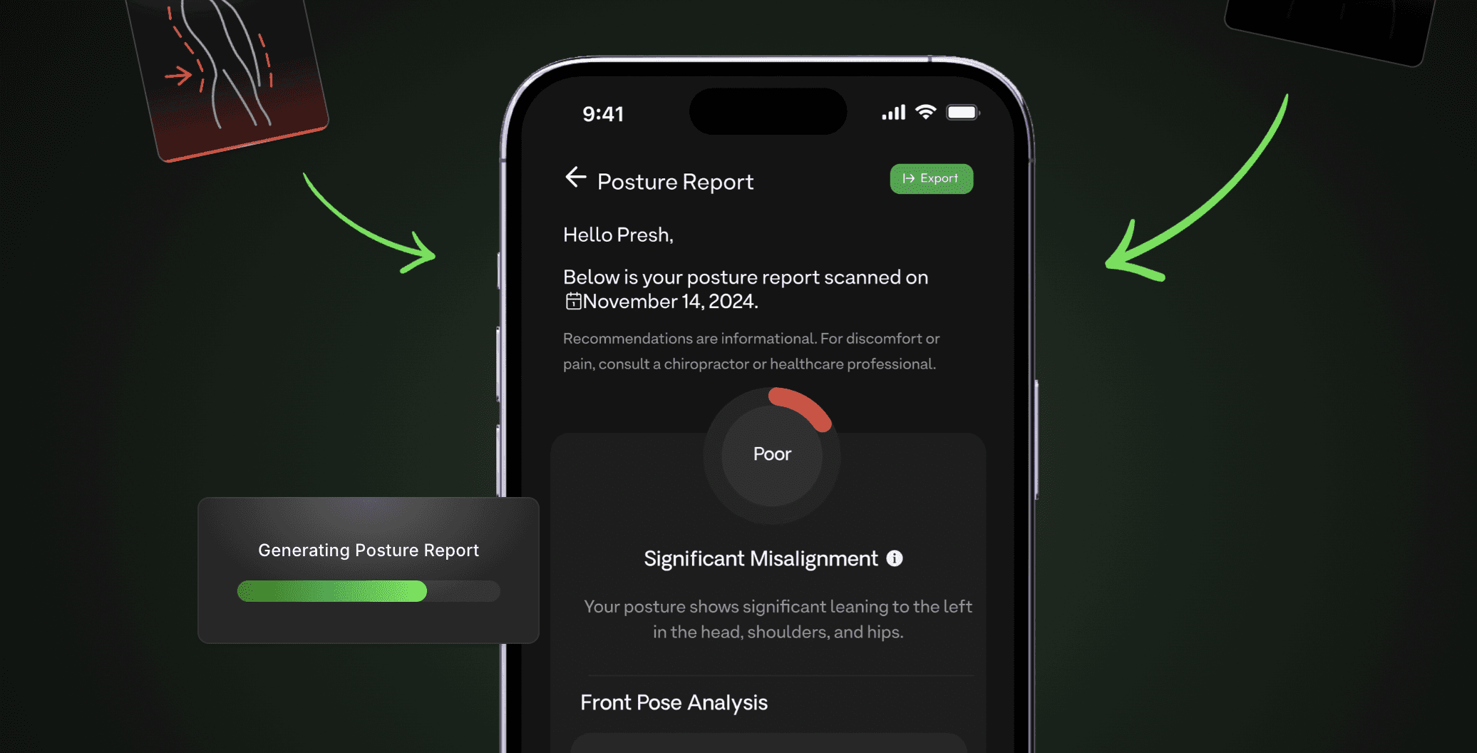 Posture AI - How Long Does It Take To Fix Your Posture