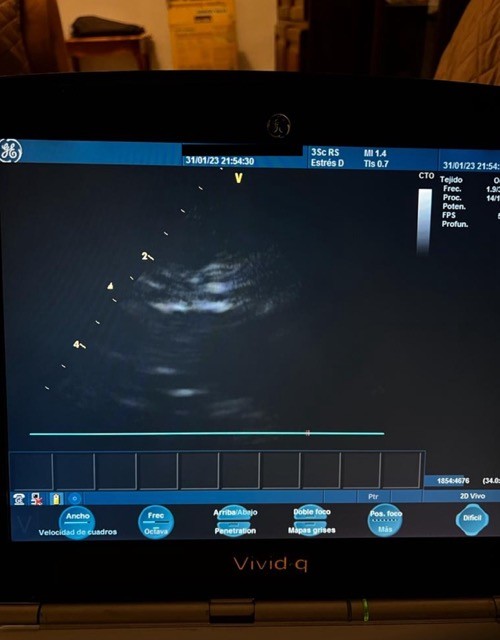 toda la imagen negra