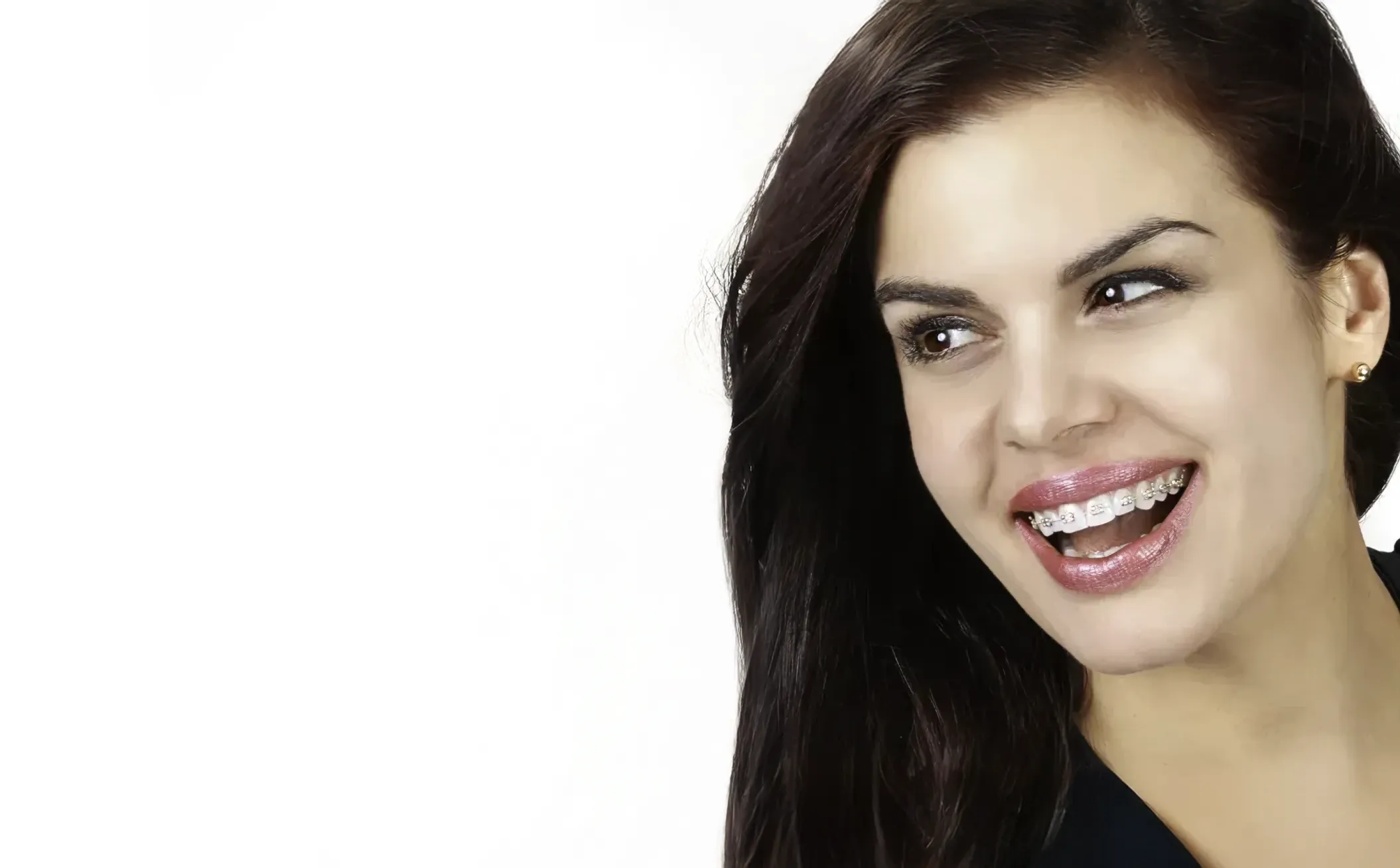 Kobieta z uśmiechem prezentująca efekty bondingu na swoich zębach.