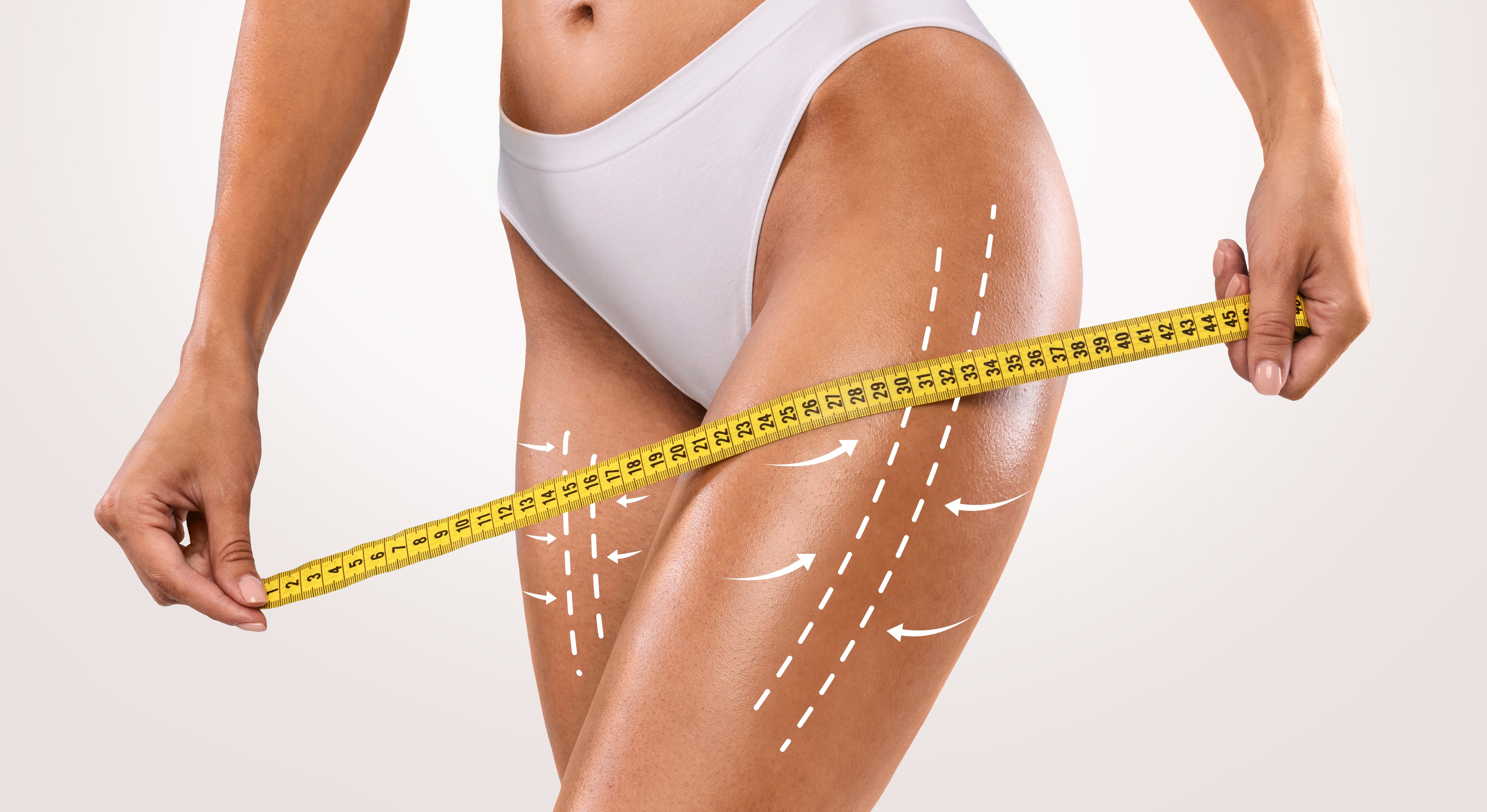 Oberschenkelstraffung in der Türkei