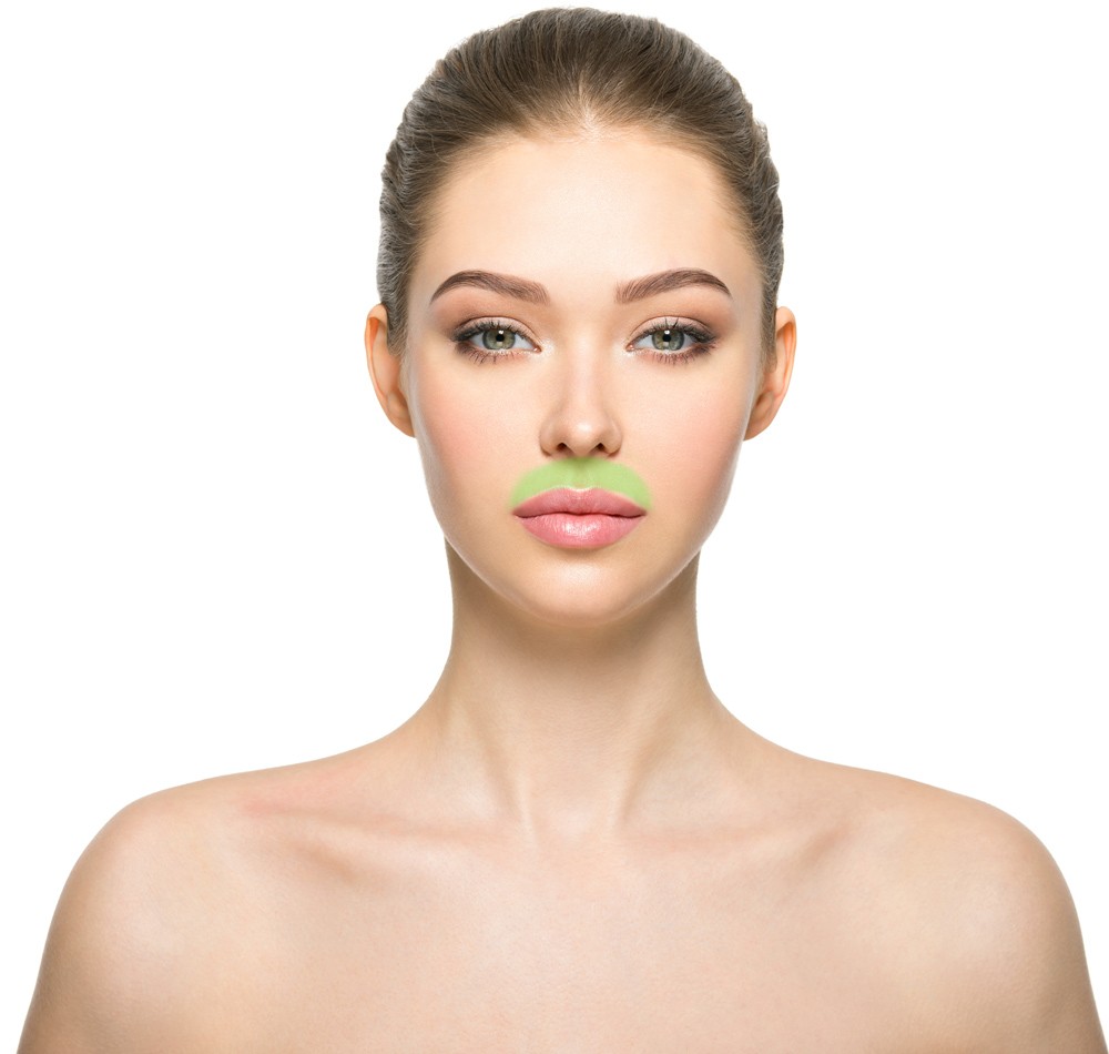 upper lip laser hair removal zone