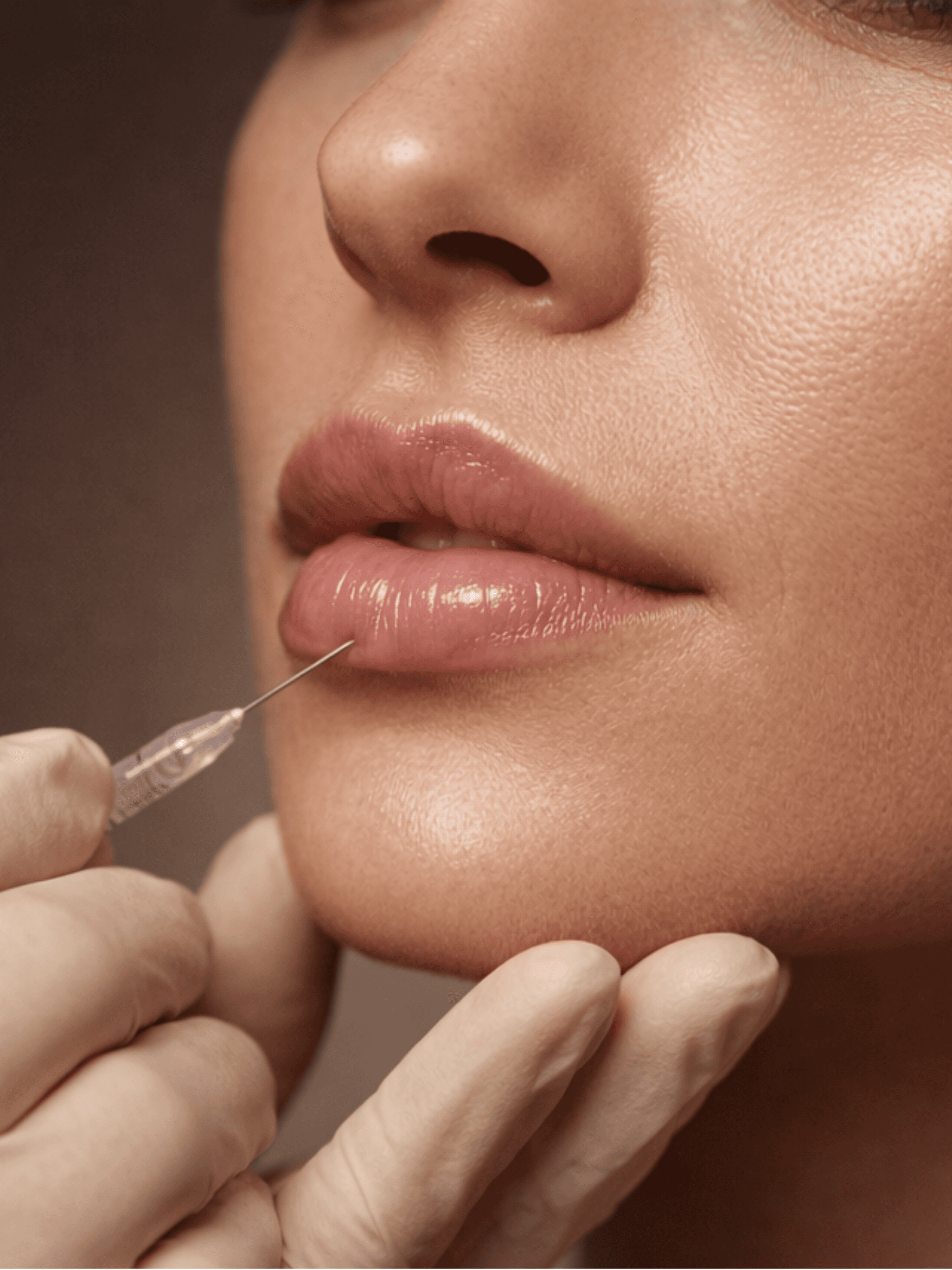 Dermal filler injections for facial volume at clinic in Irvine California