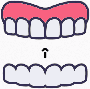 Invisalign clear aligner orthodontic treatment icon