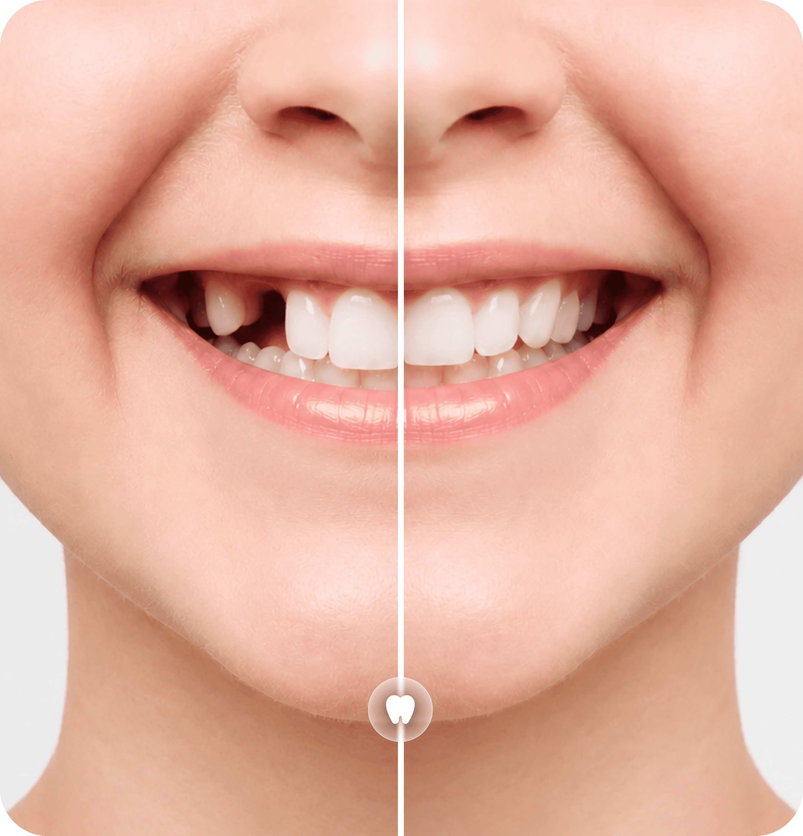 Transformation Teeth