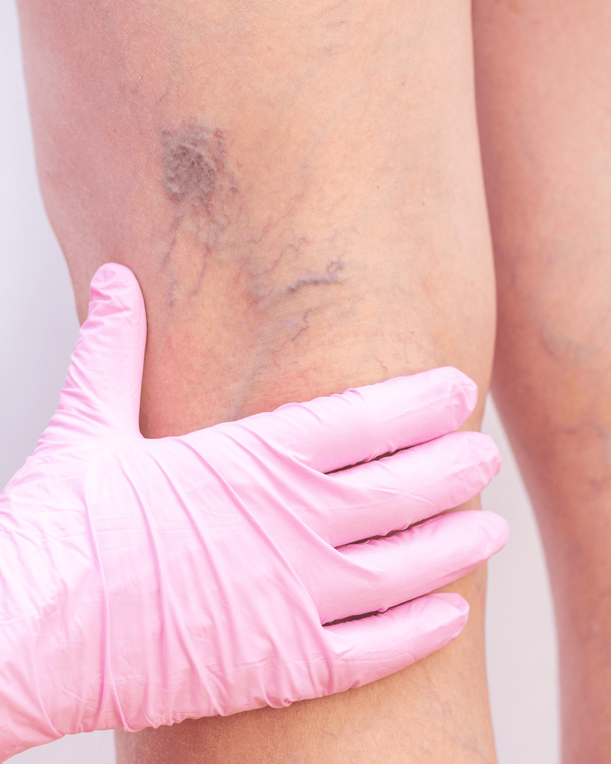 A close up of a woman with freckles on her arm