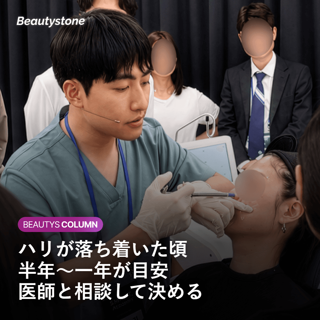 ハリ感が落ち着いた頃を目安に再施術を検討するタイミングのイメージ