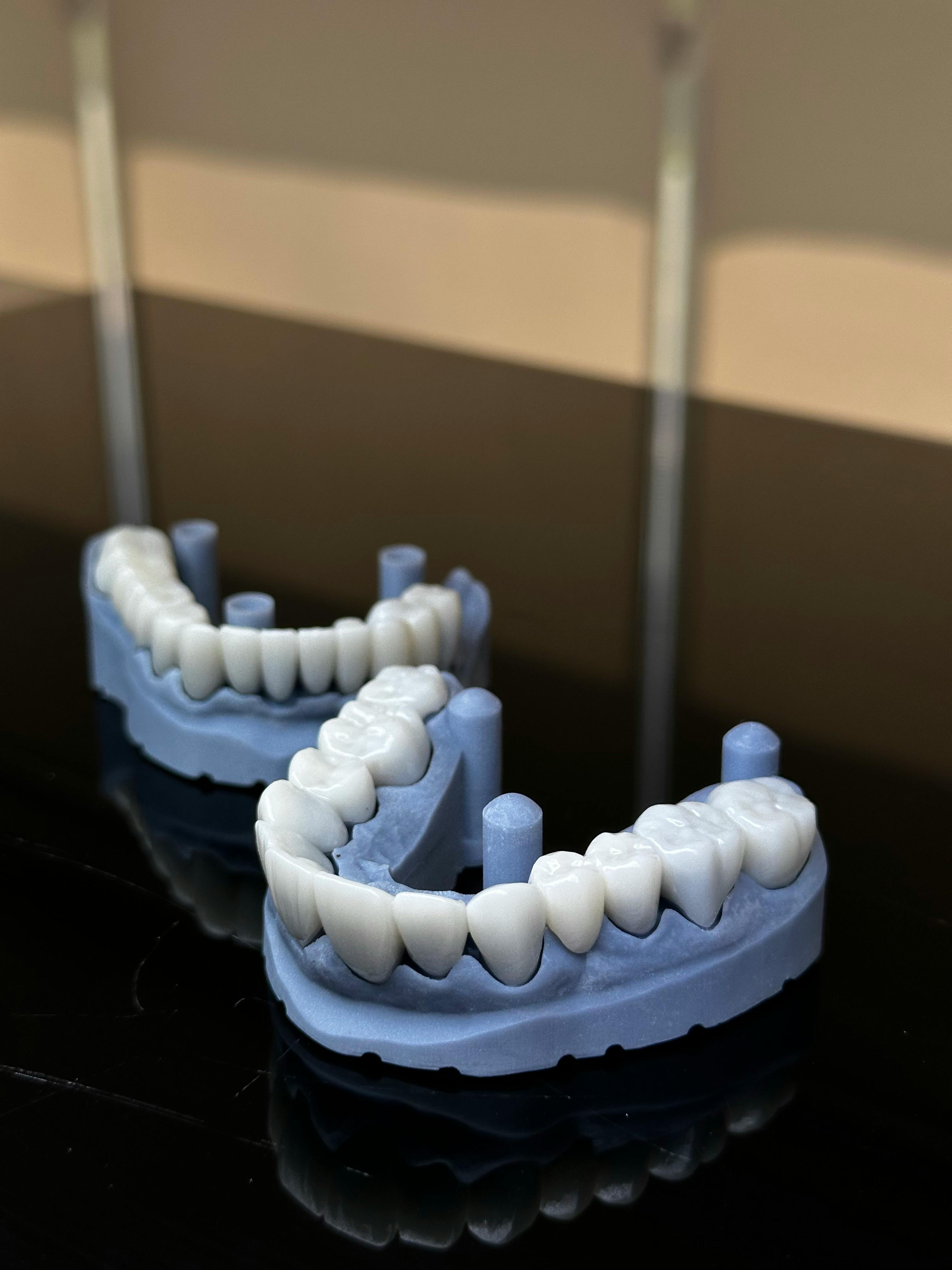 Dental Implant Surgery