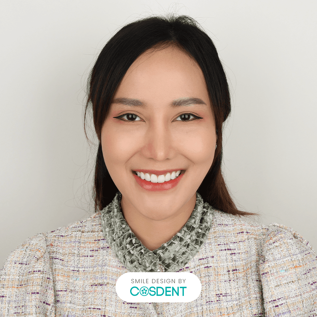 หน้ายาว ยิ้มกว้าง 16 ซี่