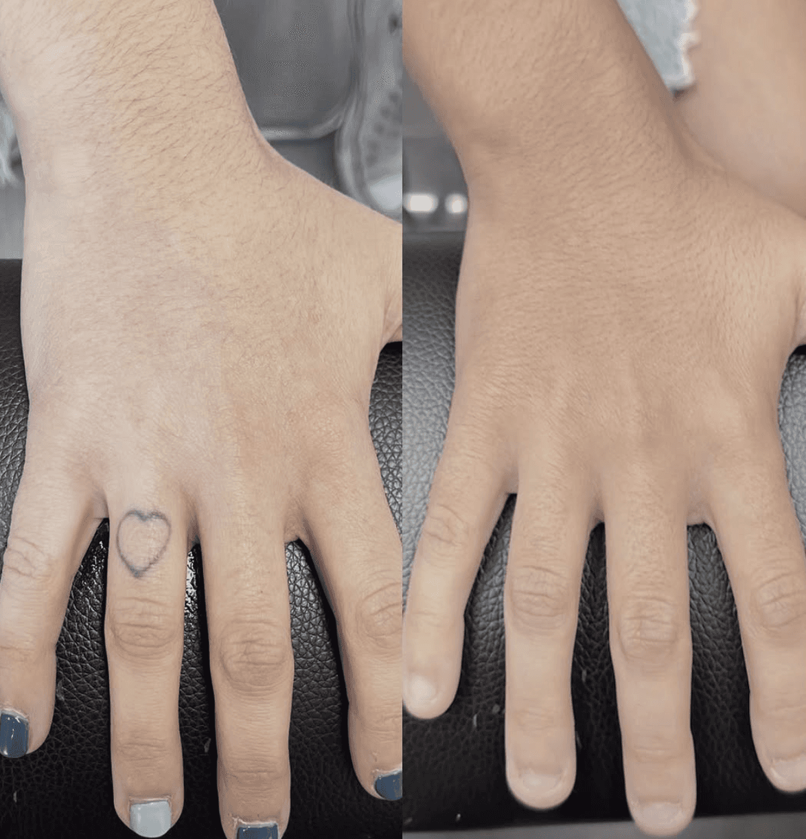 Haarpigmentierung Schweiz