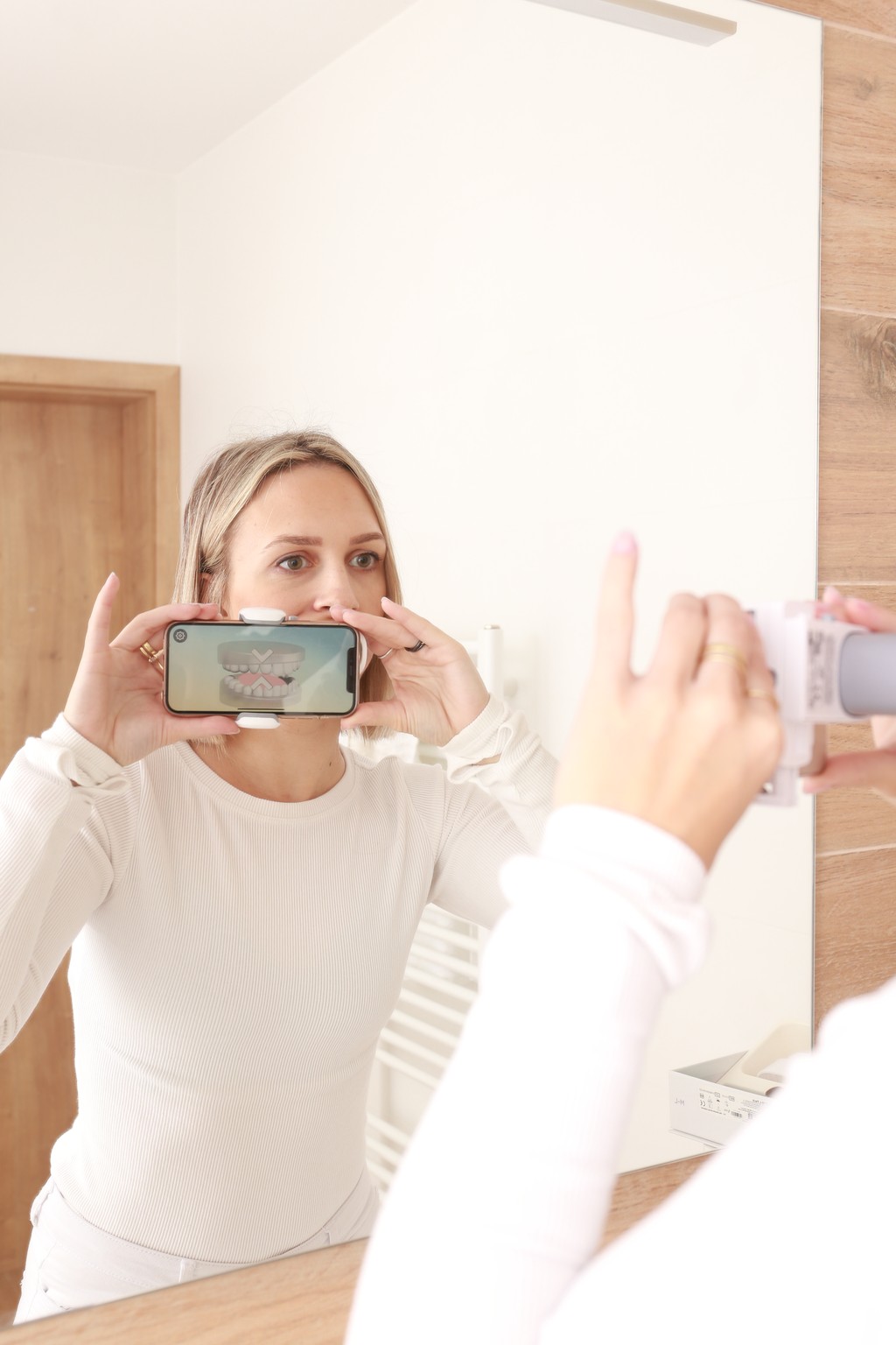 Dental monitoring