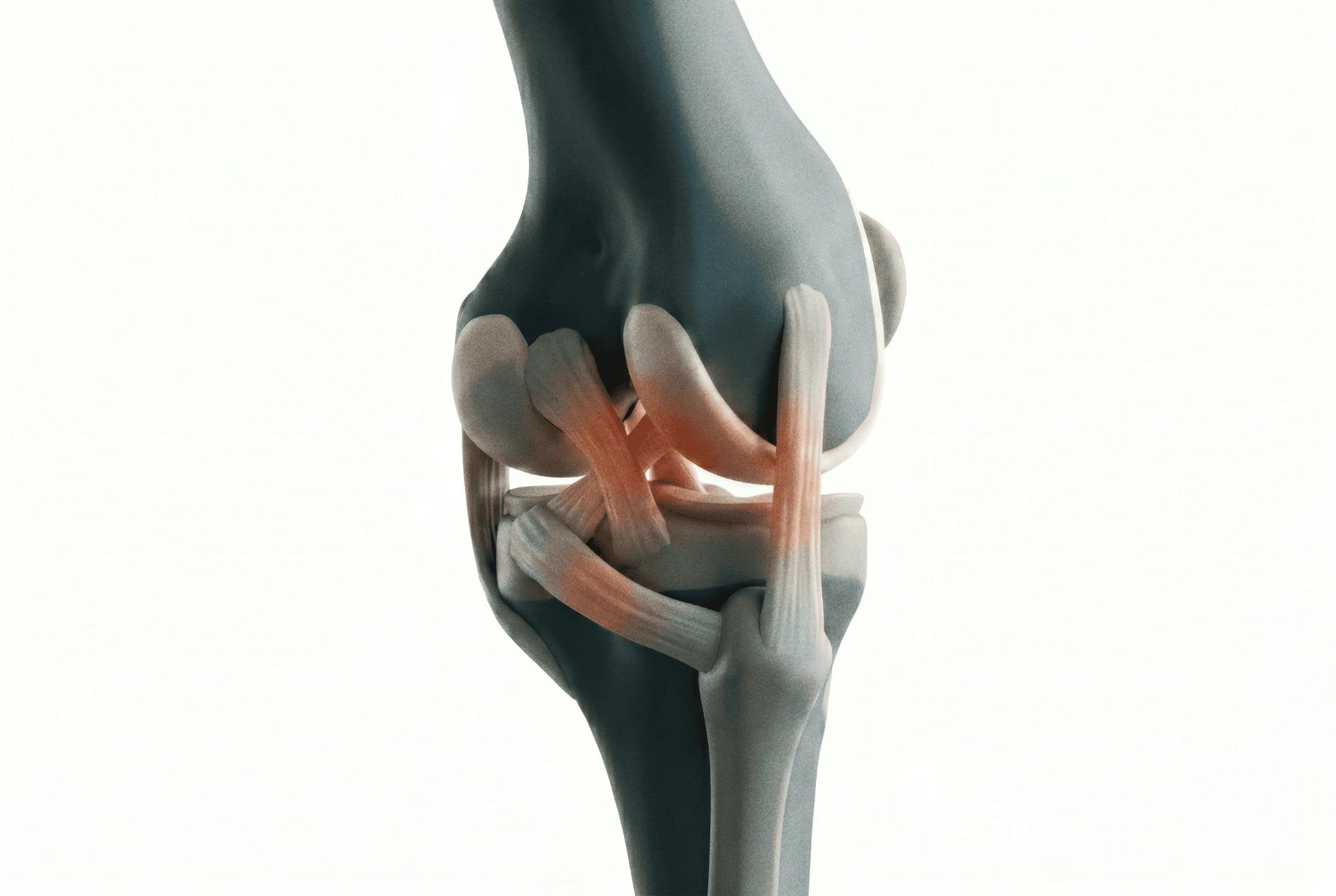Adult PLC Injury