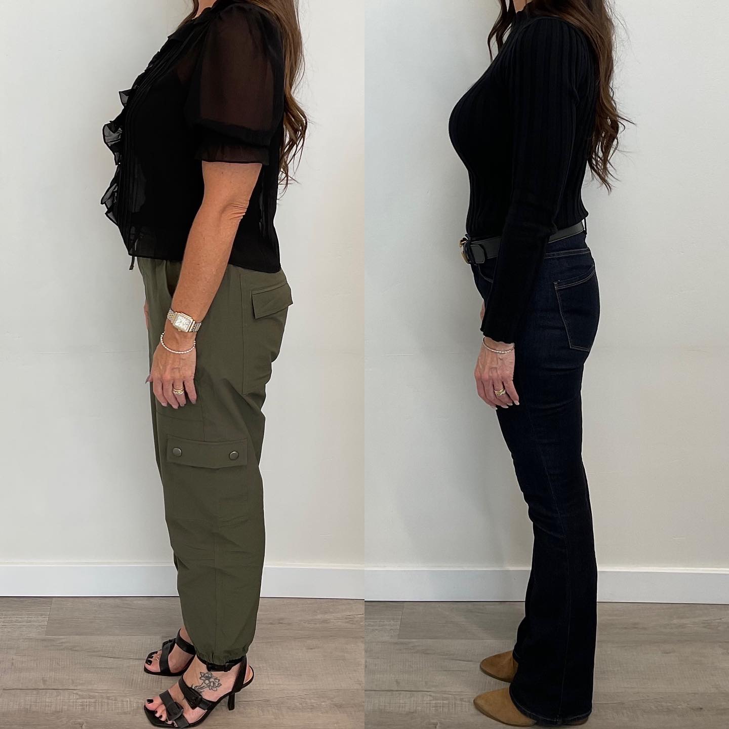 A before and after image of a woman depicting her medical weight Loss results