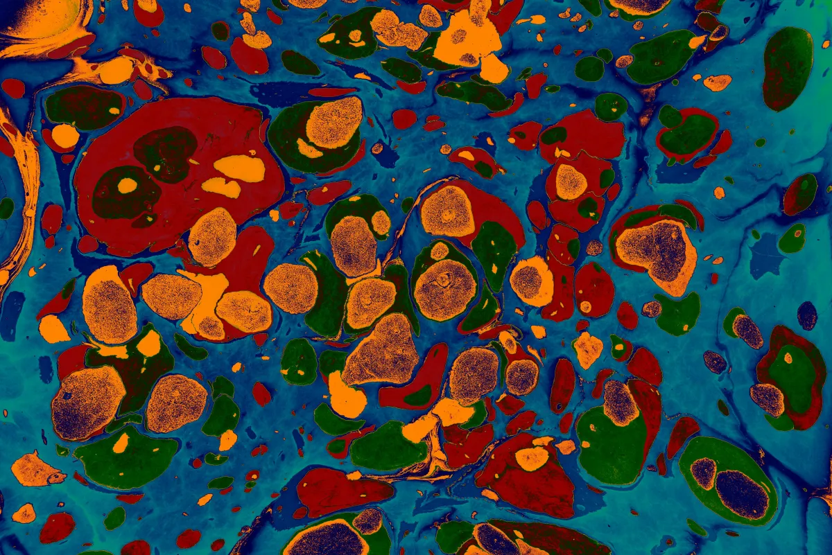 What Is the Gut Microbiome?