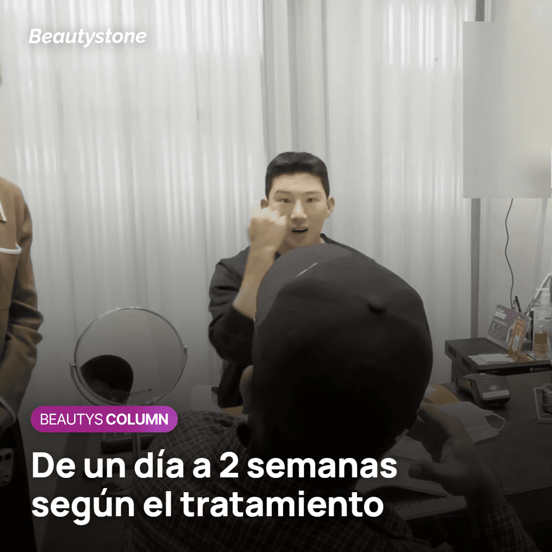 Margen antes de volar según el tipo de tratamiento