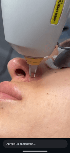 silver car headlight in grayscale photography