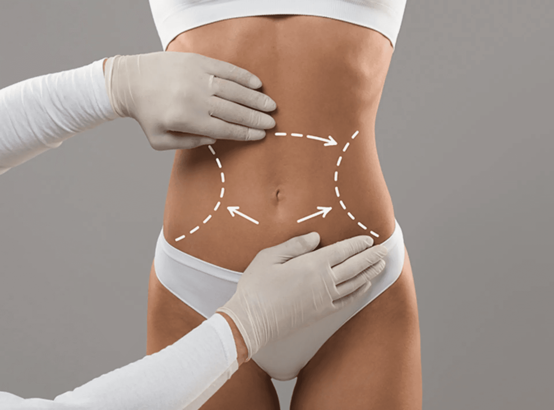 What Is “Liposculpture” (Body Contouring)? How Is It Different from Liposuction?