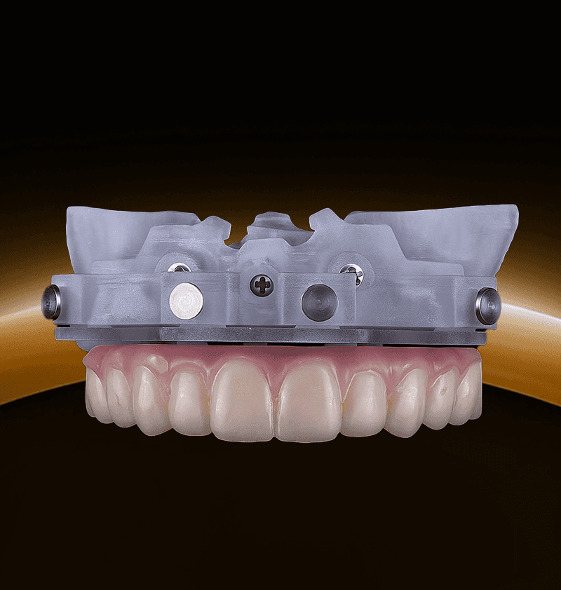 Digital Treatment Planning