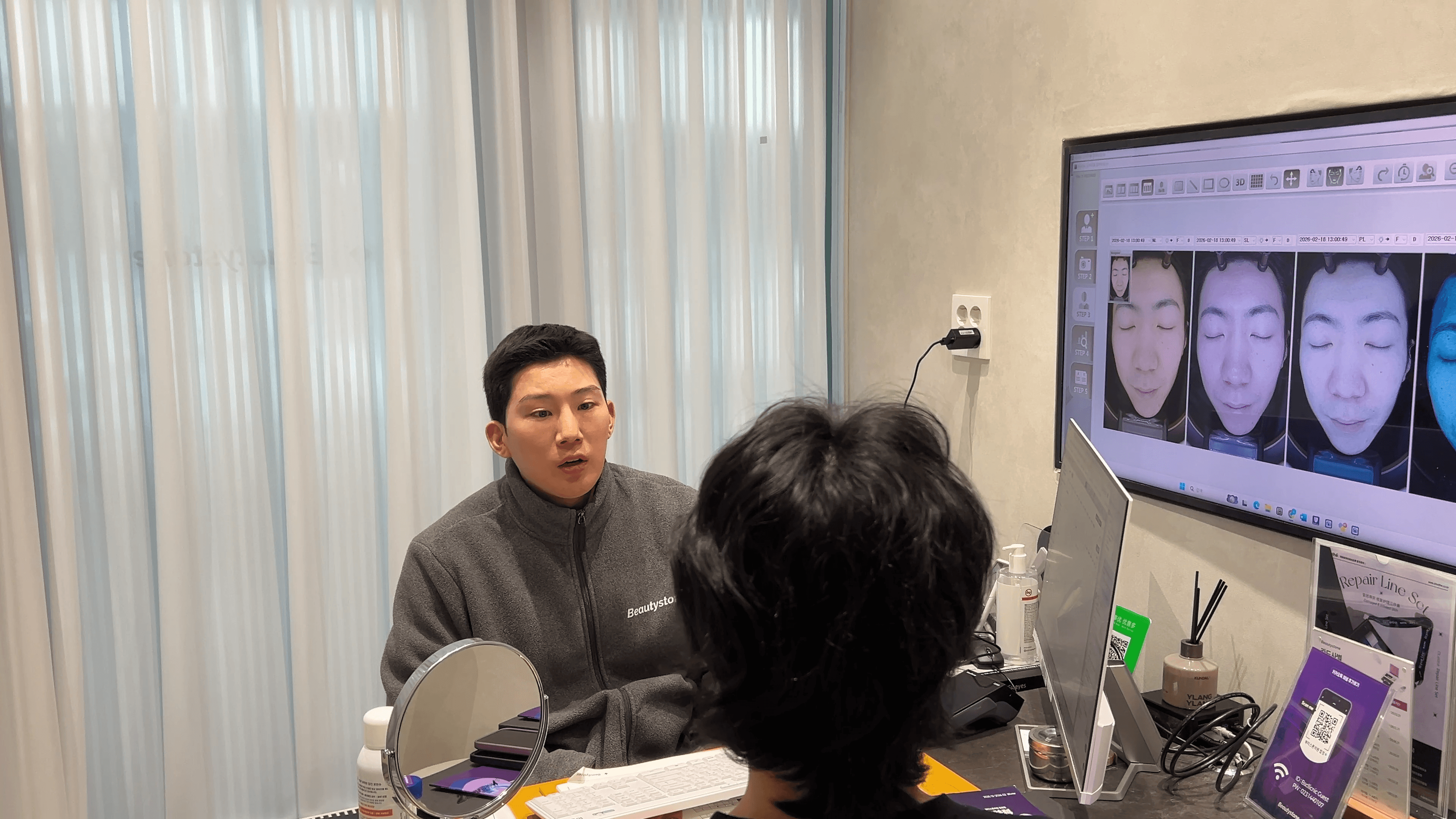 턱밑샘보톡스 효과 지속 기간 비교 이미지