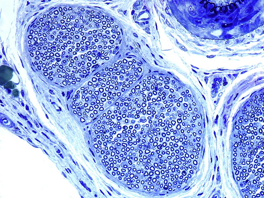 Close-up of a blue microscopic structure resembling a virus with detailed surface textures.