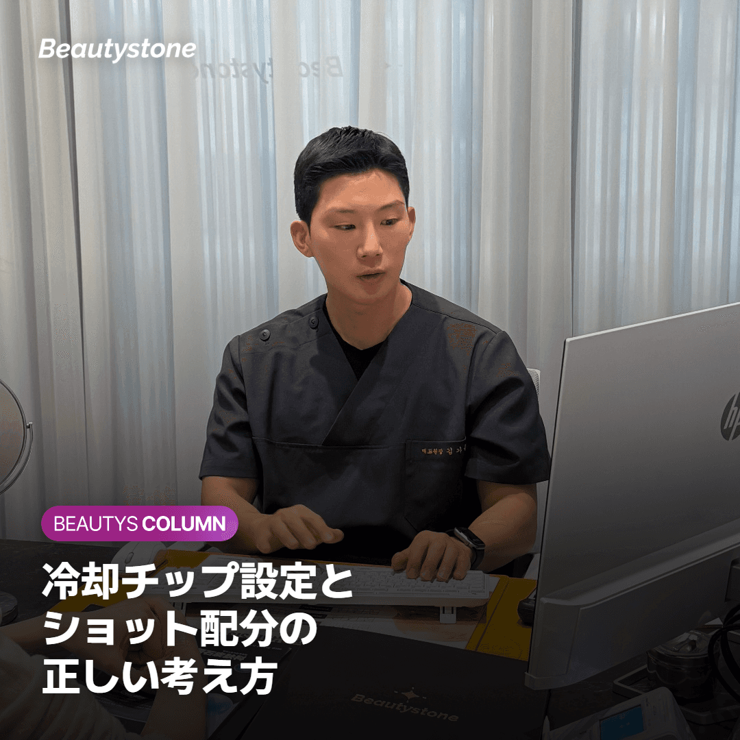 冷却チップの設定とショット配分の考え方を示すイメージ