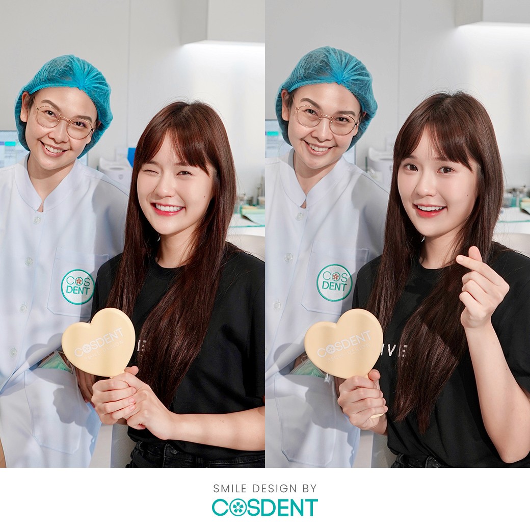 เคสทำวีเนียร์ หมอแจน cosdent