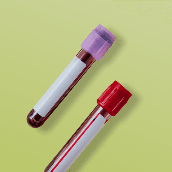 Woman doing streches