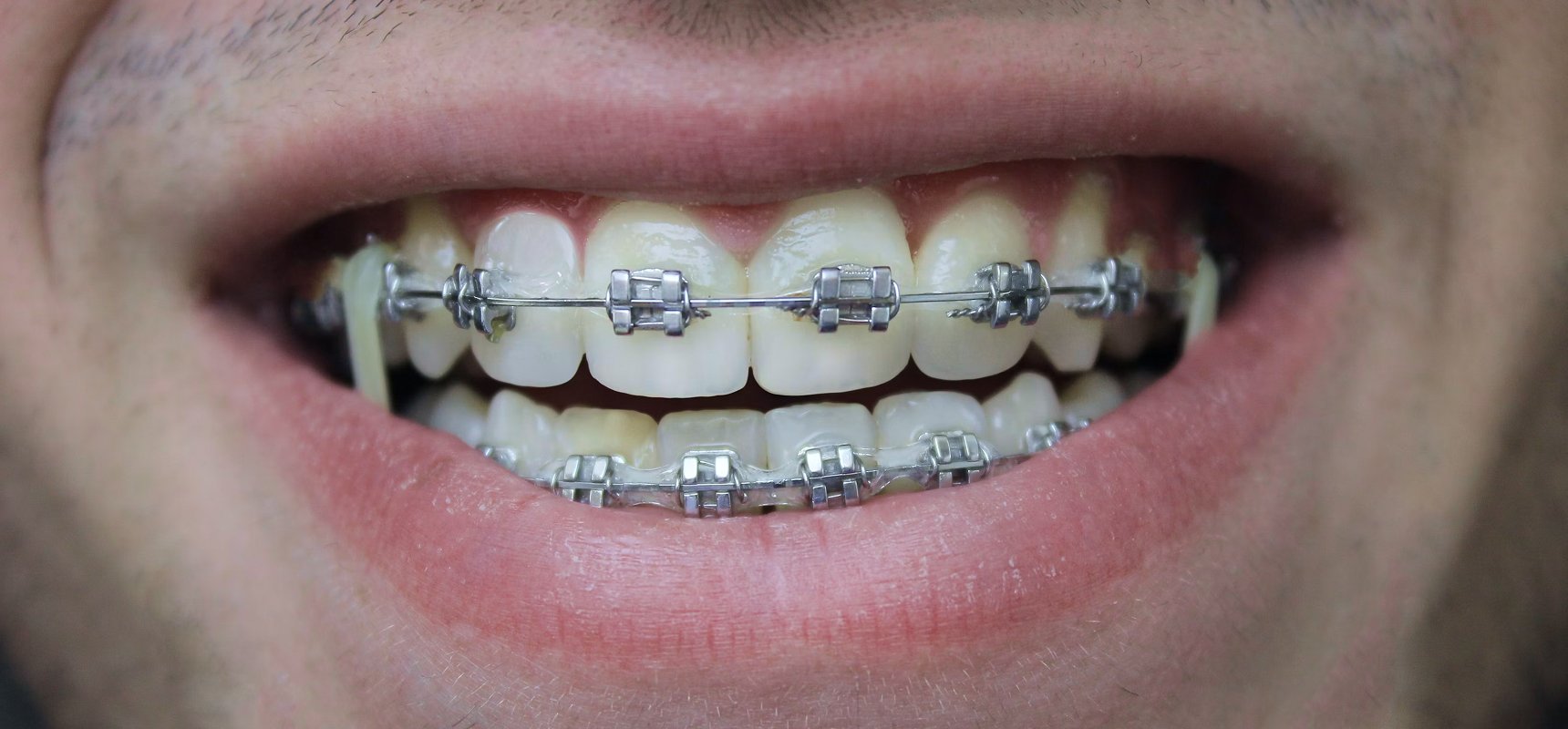 more confident smile