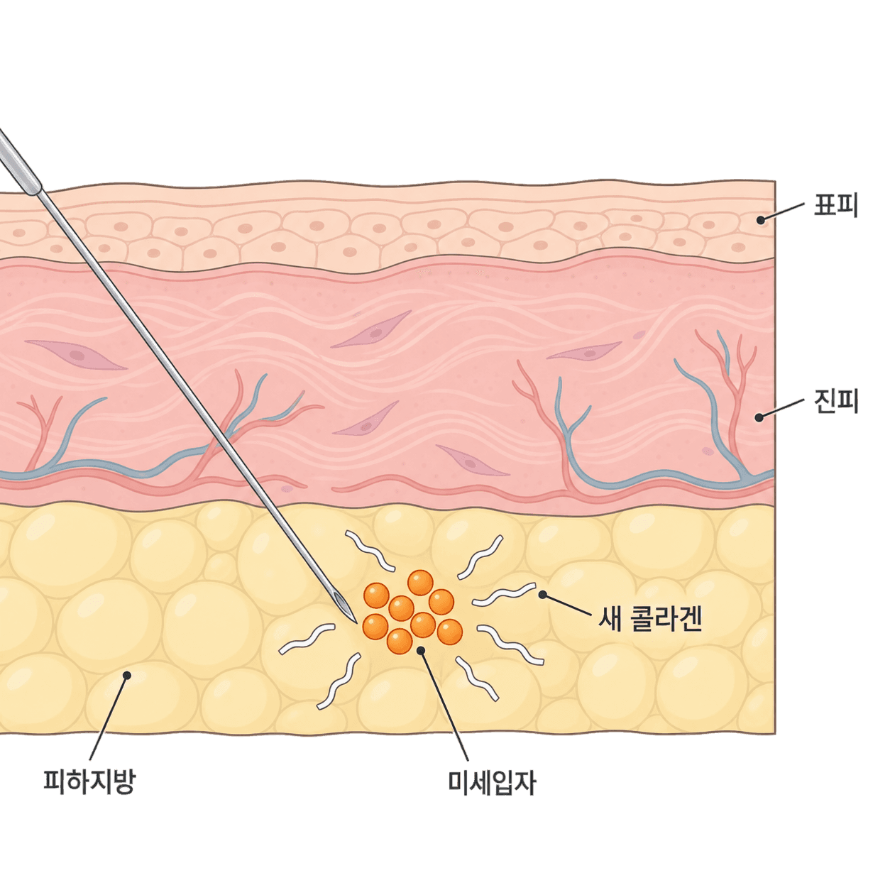 채워지는 자리와 다시 짜이는 자리가 같지 않아요.