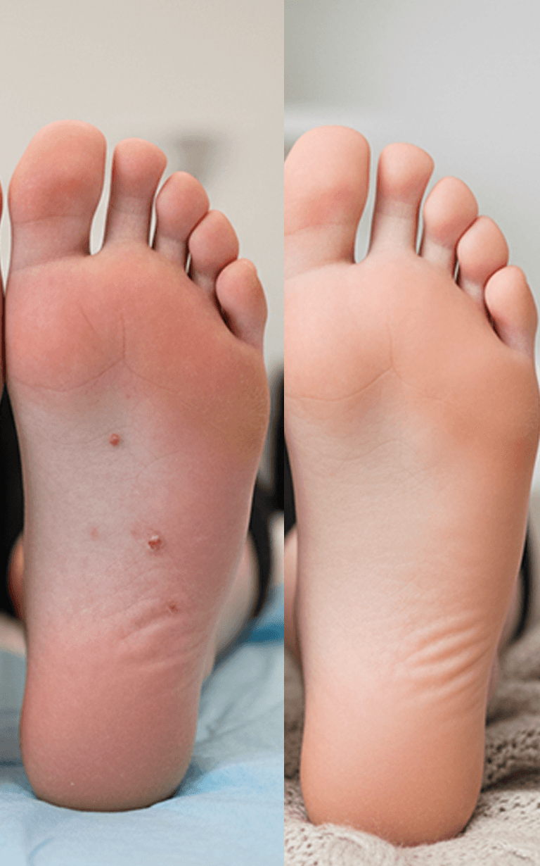 Before and after treatment - face close-up