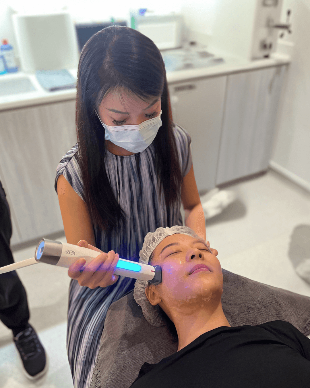 Reepot laser treatment