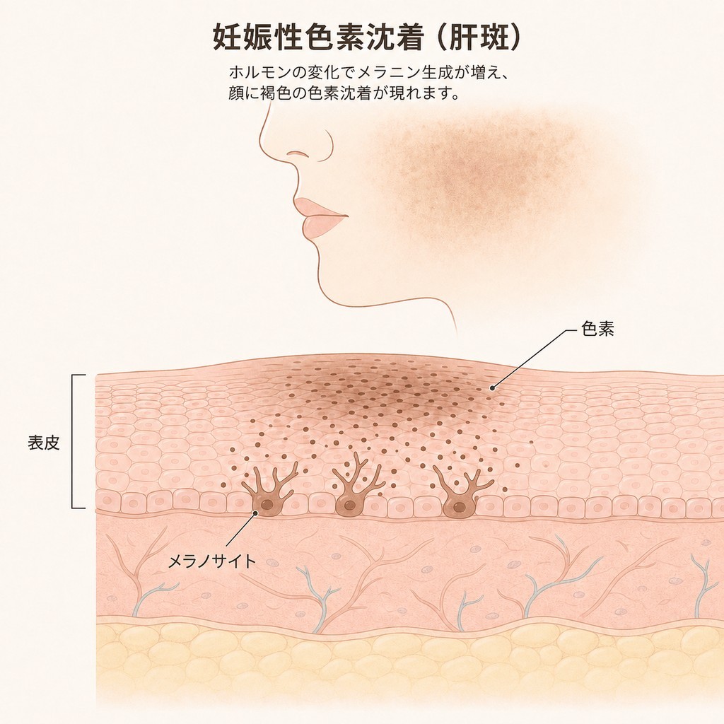 妊娠中はなぜ肌がより敏感になり、色素が濃くなるのでしょうか