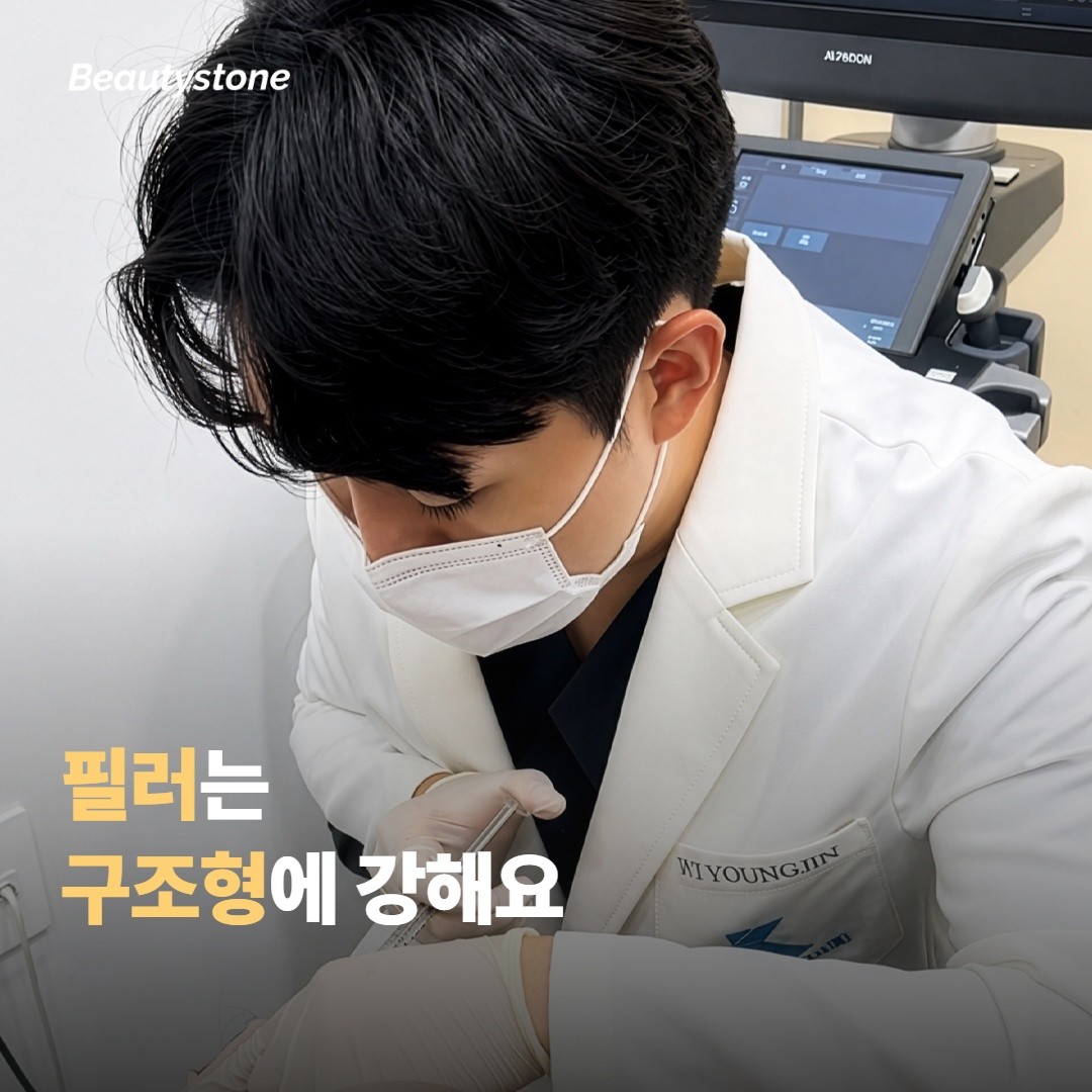 필러가 효과 보는 케이스 — 구조형 다크서클