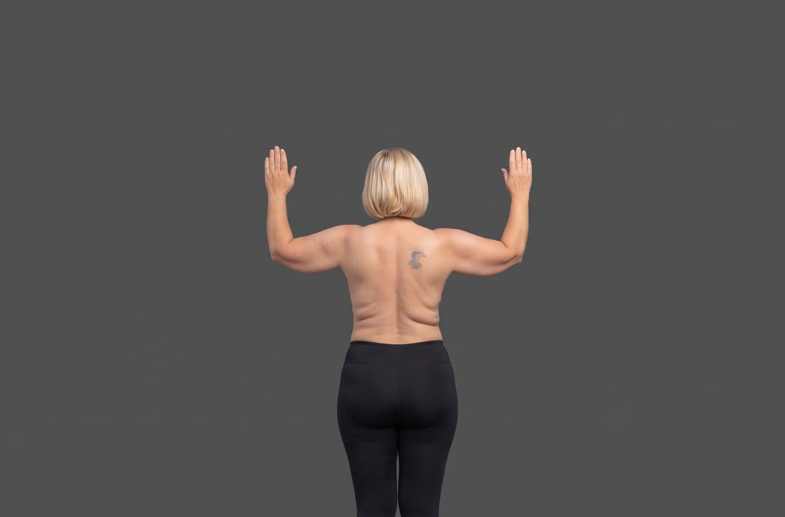 Sagging skin and excess tissue on the upper arms before upper arm lift in Istanbul