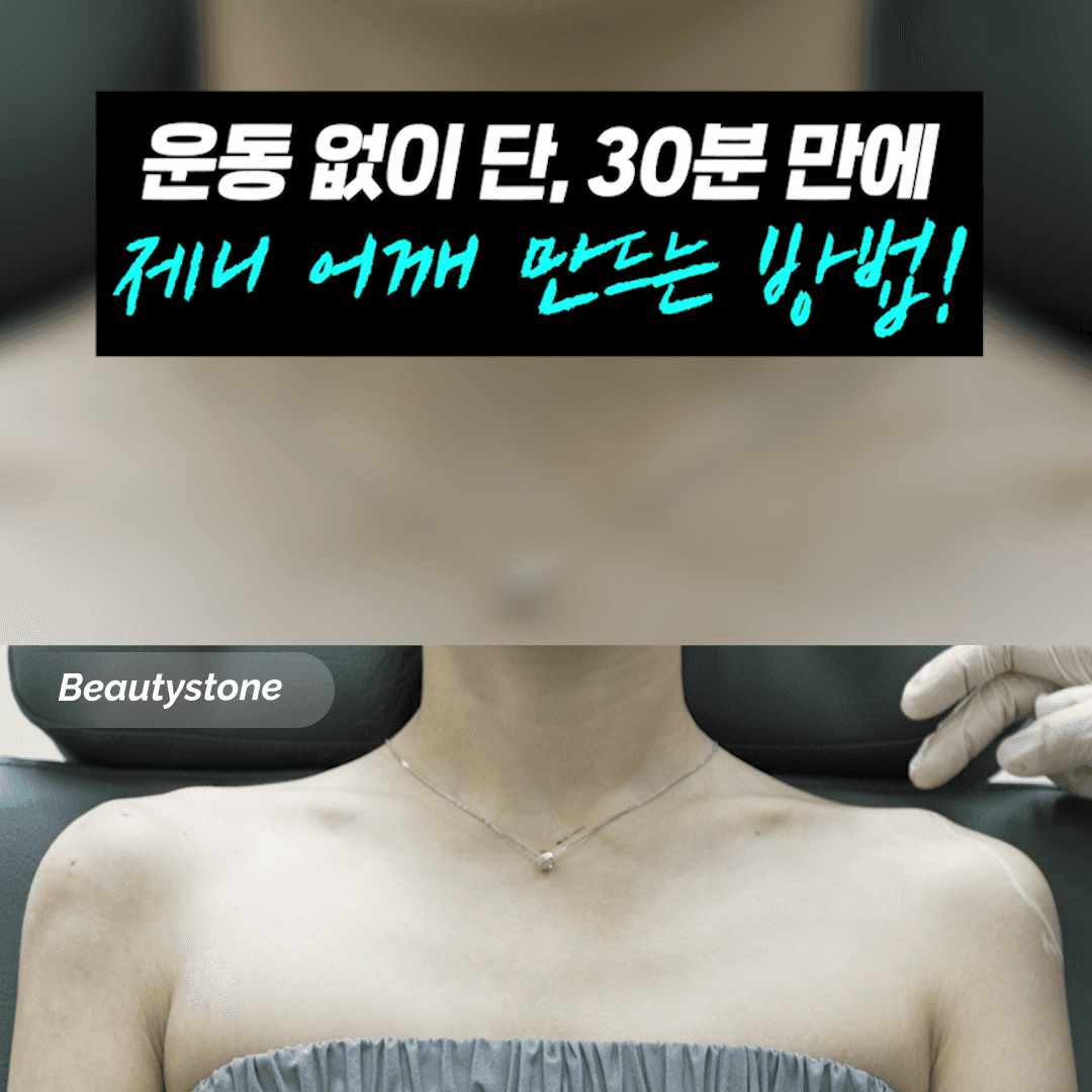 직각 어깨 만드는 필러 주입 위치와 3가지 핵심 원칙