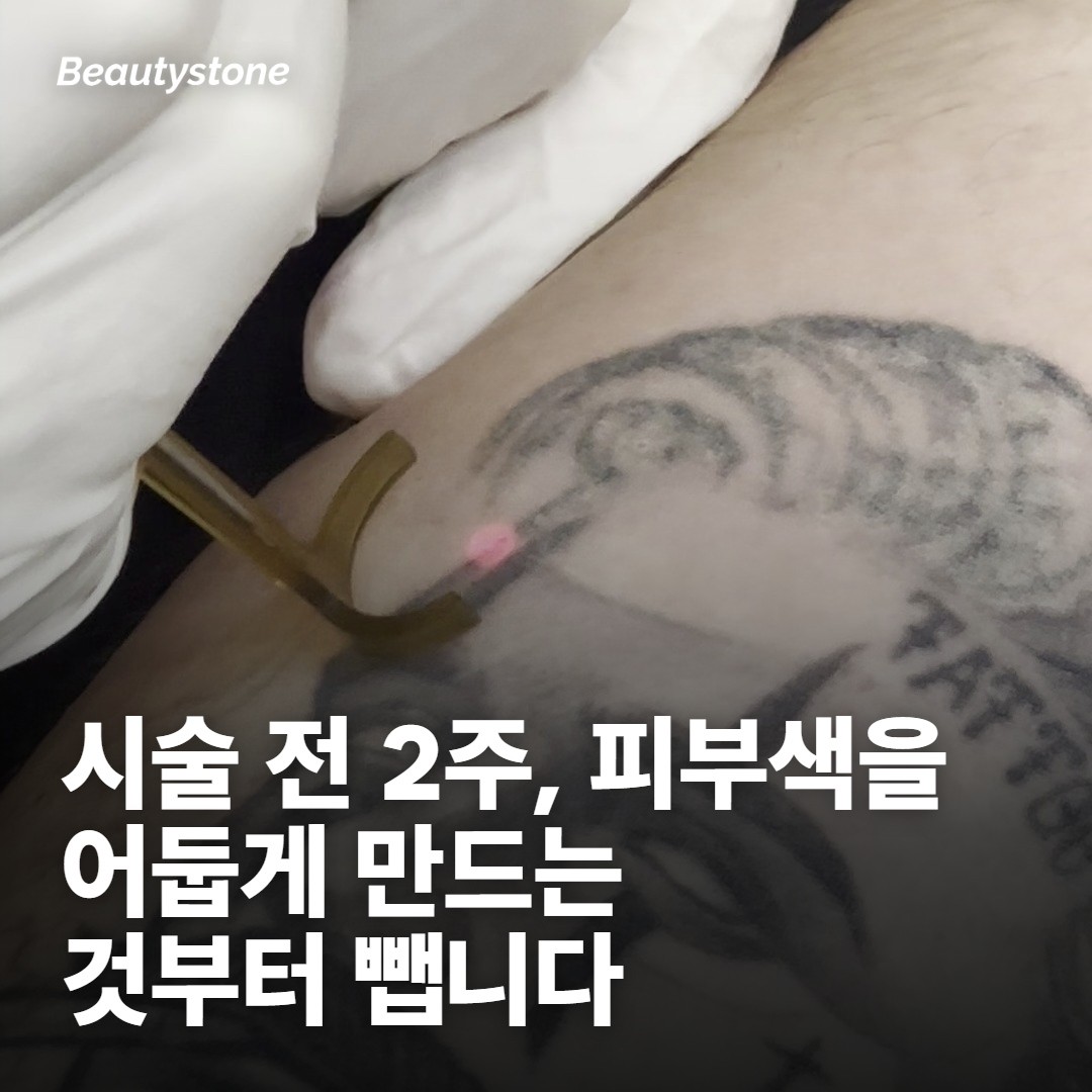 시술 전 2주 — 색을 건드리는 것부터 미뤄요