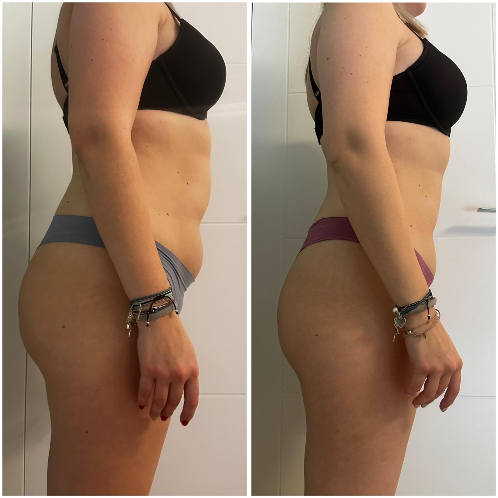 Transformation Photo