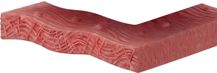 에너지 시술 타겟 깊이 3.0mm — 진피 하부 콜라겐 리모델링 층