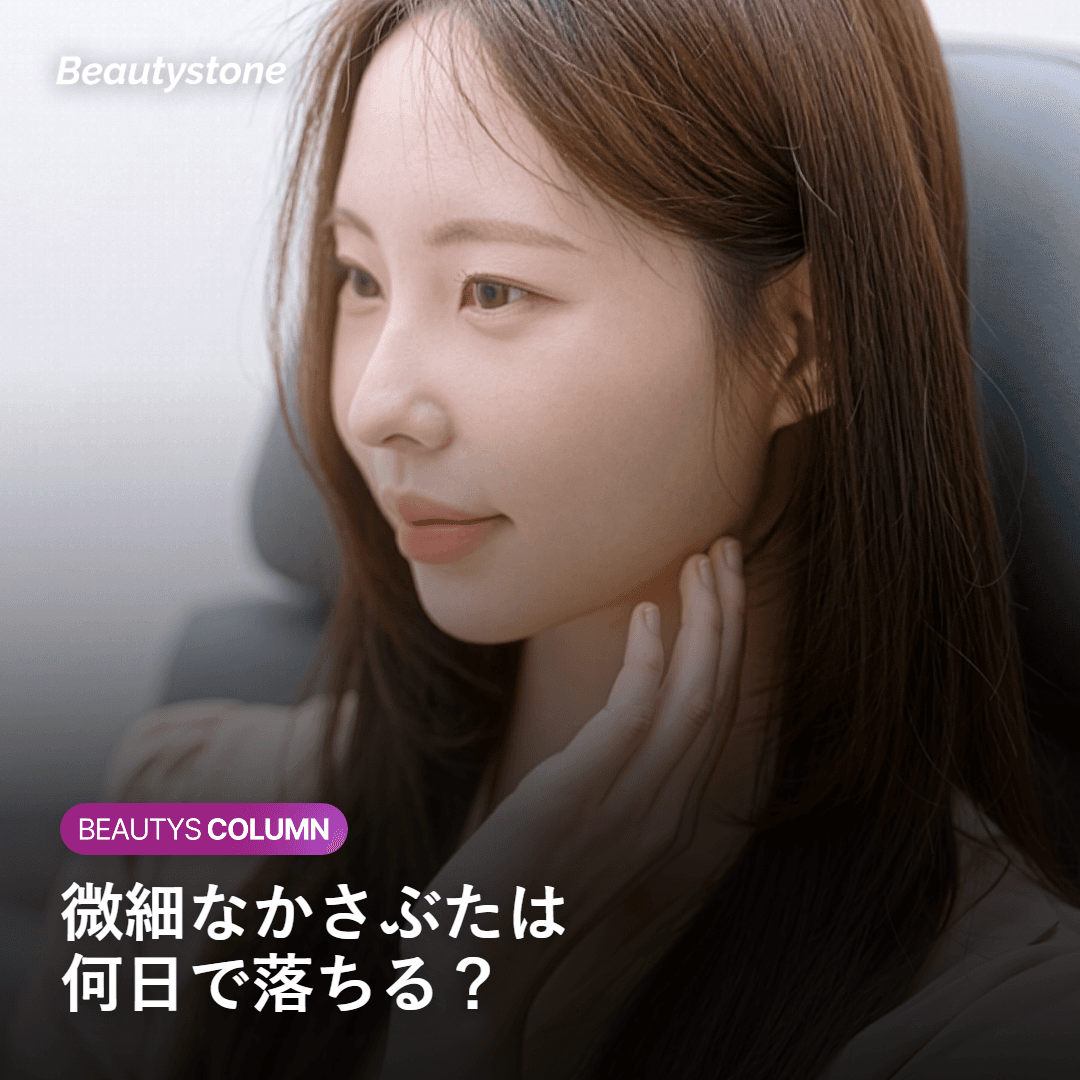シークレットRF後のかさぶたと赤みが数日で落ち着く経過を示すイメージ