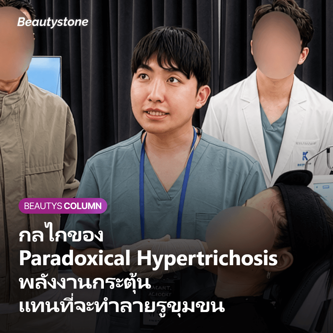 กลไกการกระตุ้นรูขุมขนจากเลเซอร์กำจัดขน